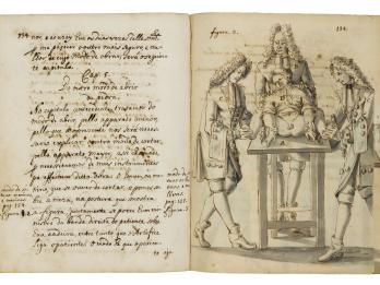 Facing-page manuscript with illustration on right page depicting individual lying on operating table with two men in curly wigs in coats and breeches holding down his wrists and feet and another with his hand on patient's shoulders; and left page with Portuguese text only.