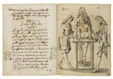 Facing-page manuscript with illustration on right page depicting individual lying on operating table with two men in curly wigs in coats and breeches holding down his wrists and feet and another with his hand on patient's shoulders; and left page with Portuguese text only.