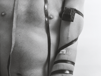 Photograph showing torso and arm, with bandage and tefillin attached.