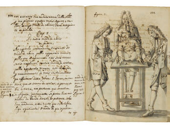 Surgical Illustration Facing-page manuscript with illustration on right page depicting individual lying on operating table with two men in curly wigs in coats and breeches holding down his wrists and feet and another with his hand on patient's shoulders; and left page with Portuguese text only.