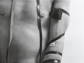 Photograph showing torso and arm, with bandage and tefillin attached.