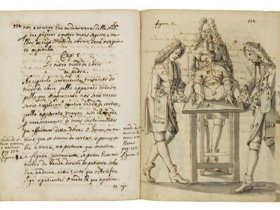 Surgical Illustration Facing-page manuscript with illustration on right page depicting individual lying on operating table with two men in curly wigs in coats and breeches holding down his wrists and feet and another with his hand on patient's shoulders; and left page with Portuguese text only.